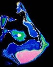 breast xray