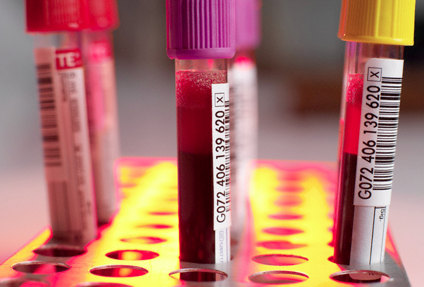 Multiple vials of blood in a tray