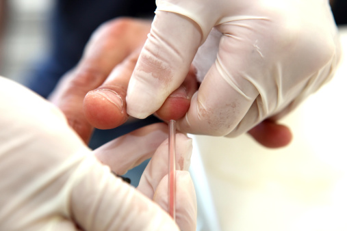Blood Test