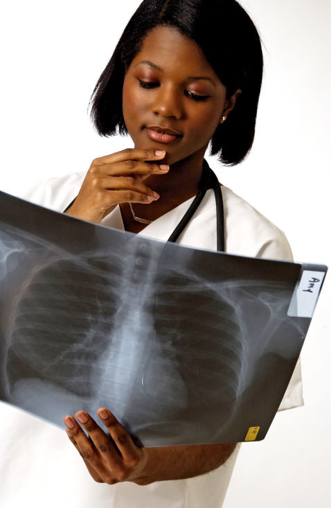 Chronic obstructive pulmonary disease