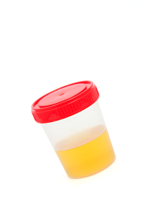 urine in container