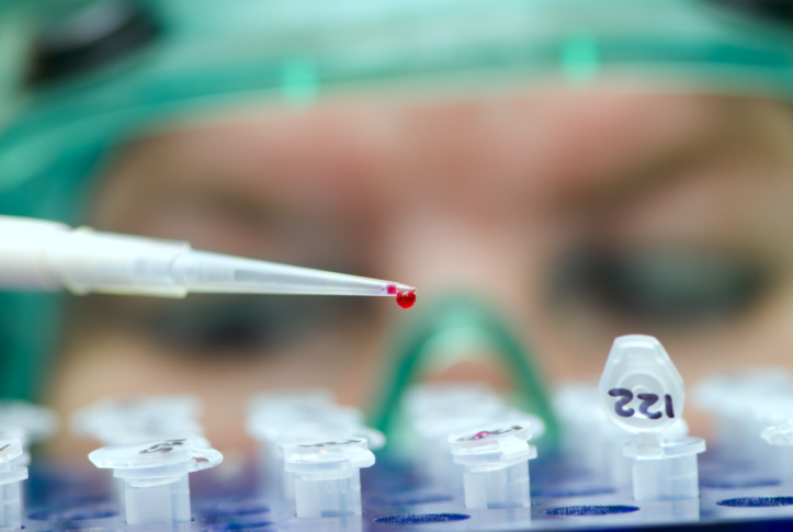 HIV symptoms in women