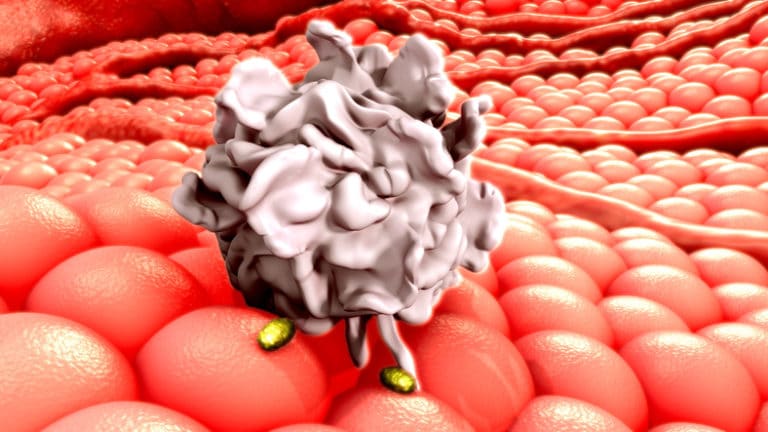 hiv symptoms