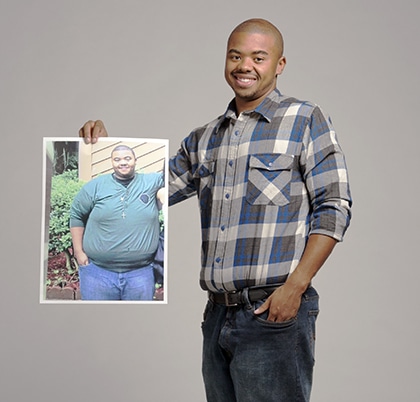 obesity