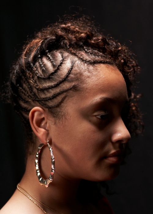 yeast infections on scalp