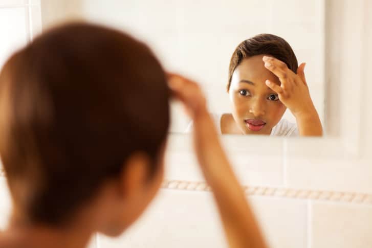 Acne face mapping
