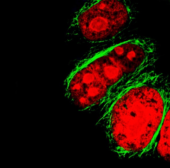 HeLa ovarian cancer cell