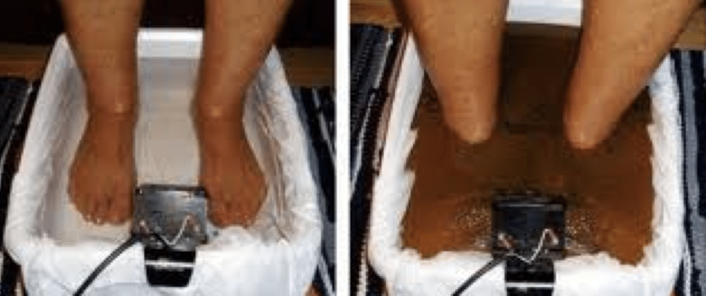 foot