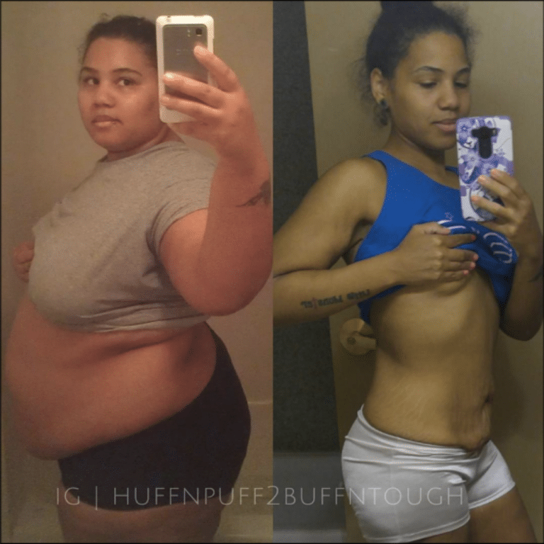 weight loss