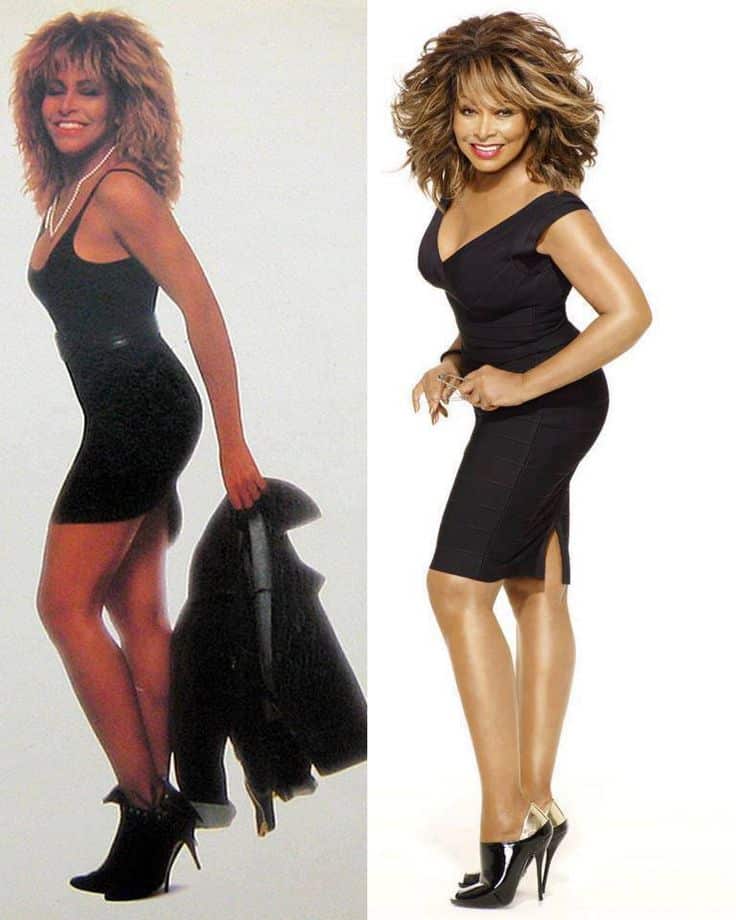 tina turner health