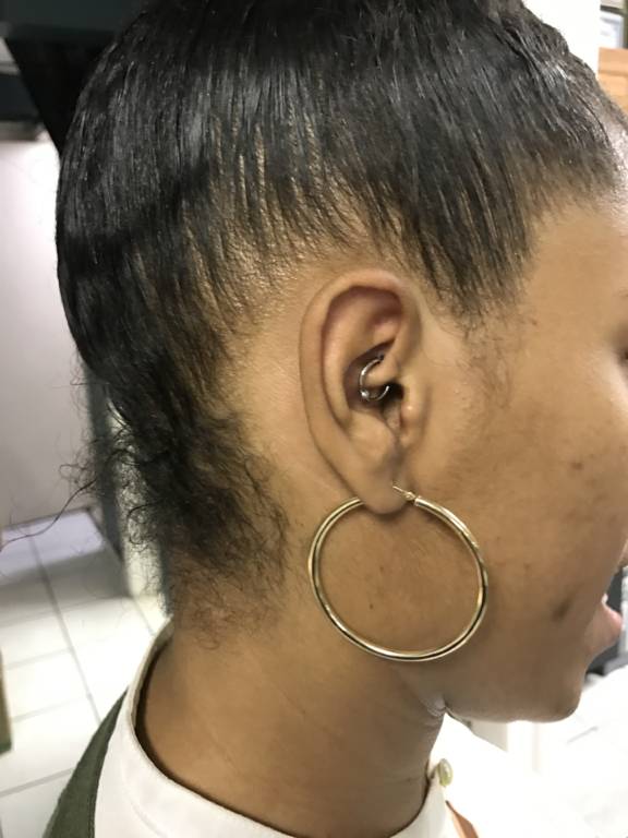 daith piercing for migraines