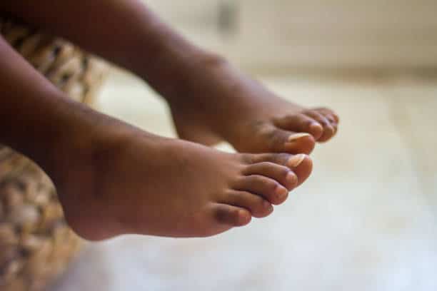 foot fungus