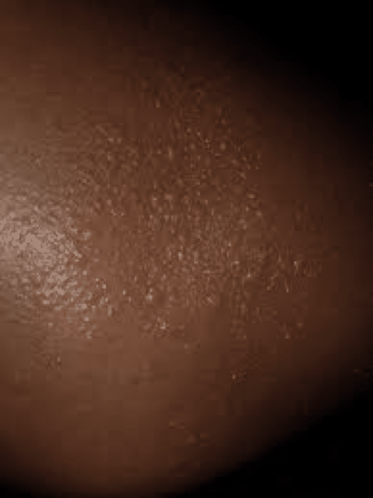 common skin rashes