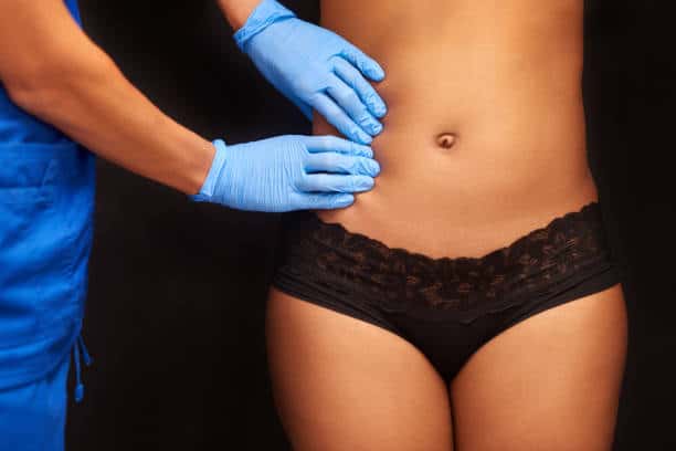 liposuction