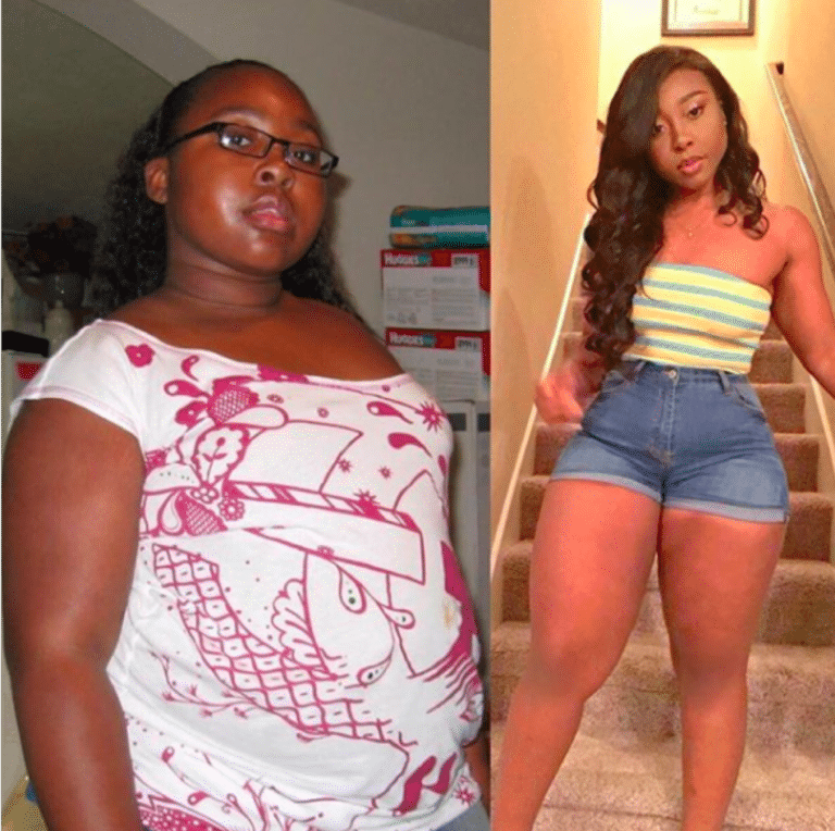 weight loss transformation