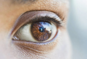 glassy eyes