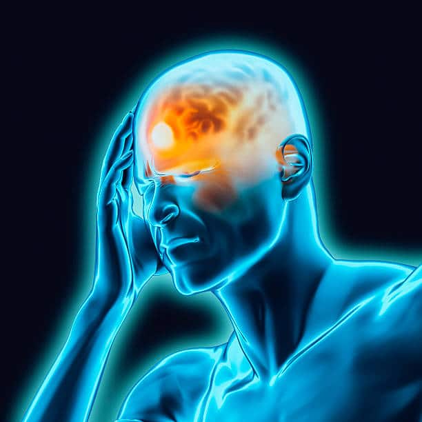 headache locations