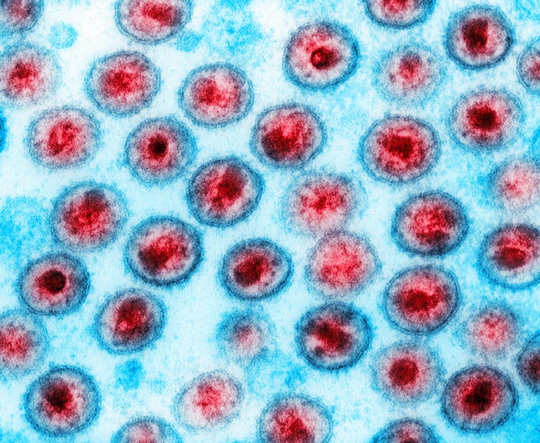 HIV strain