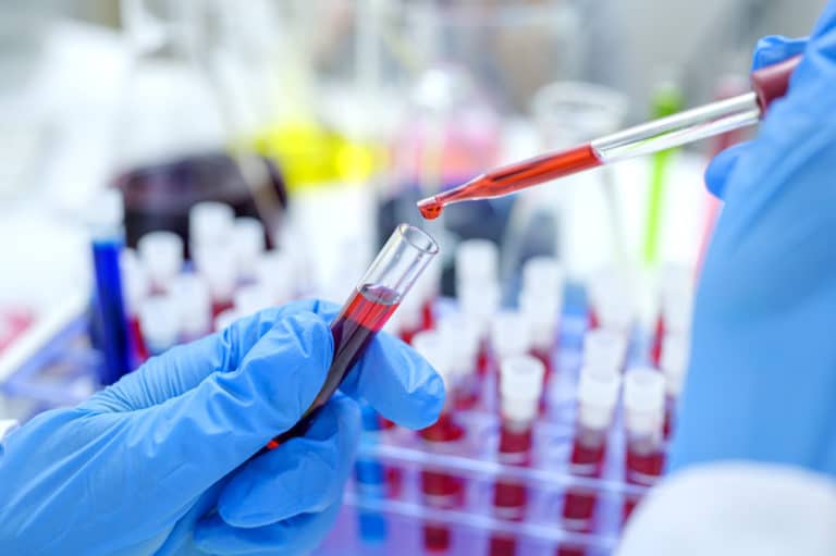 HIV Discovered