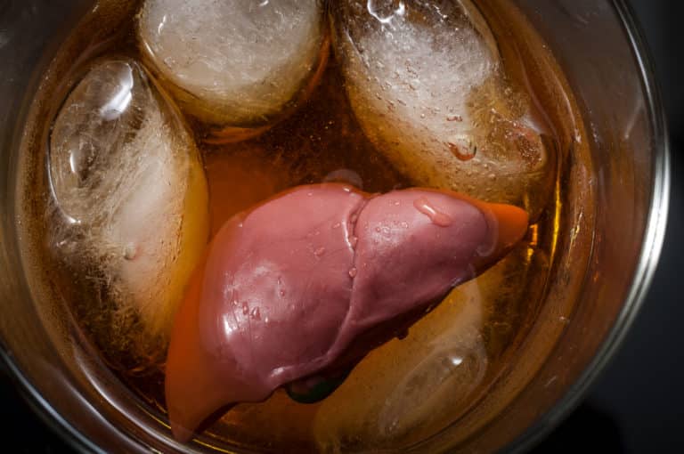 Alcoholic liver damag