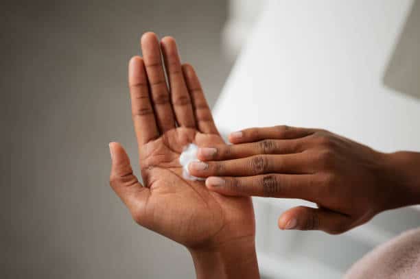 psoriasis treatment