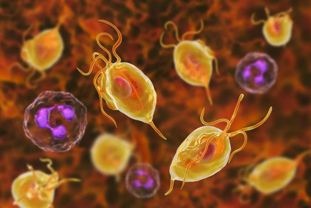 trichomoniasis