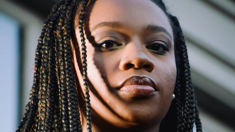 braids, traction alopecia