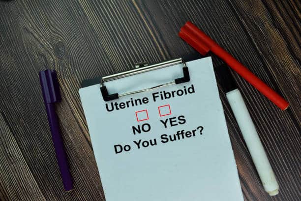 fibroids