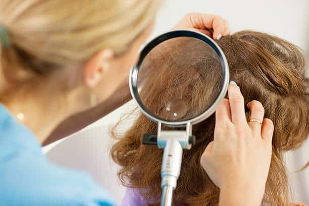 can black people get lice in their hair