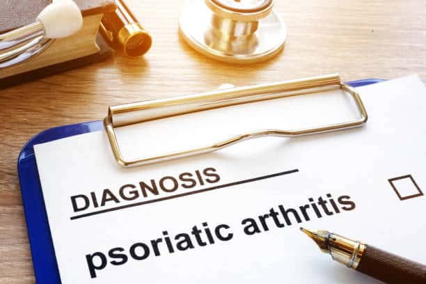 arthritis