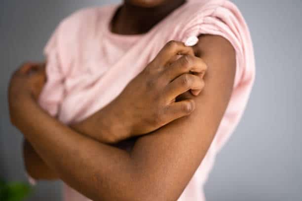 is psoriasis genetic