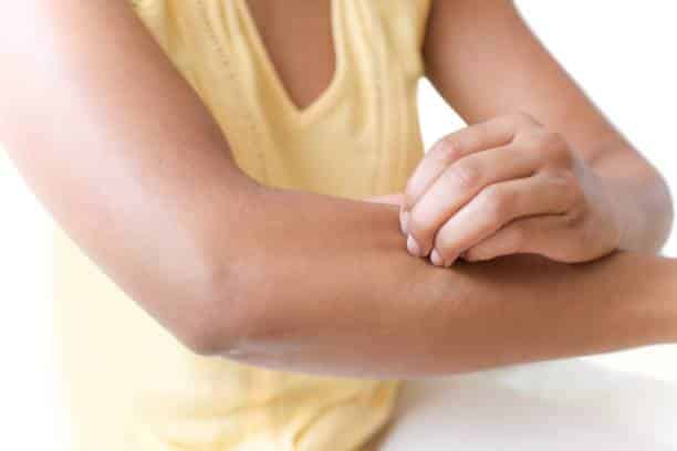 lyme disease symptoms