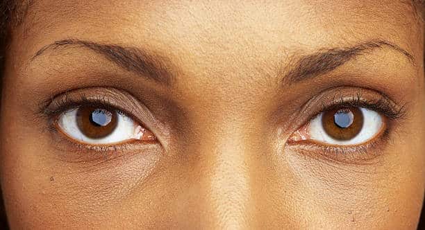 diabetic retinopathy