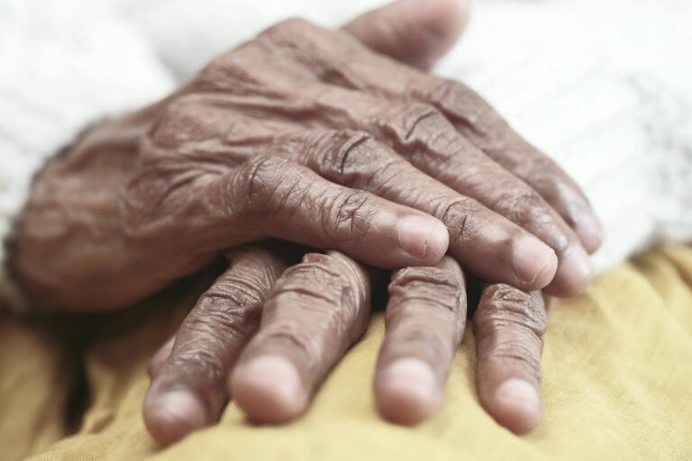 parkinsons disease