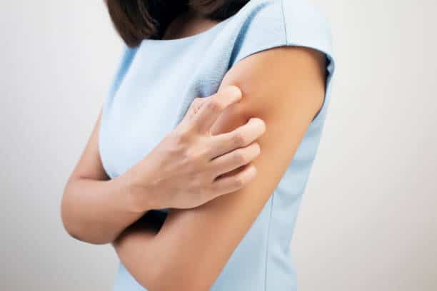 skin lesions