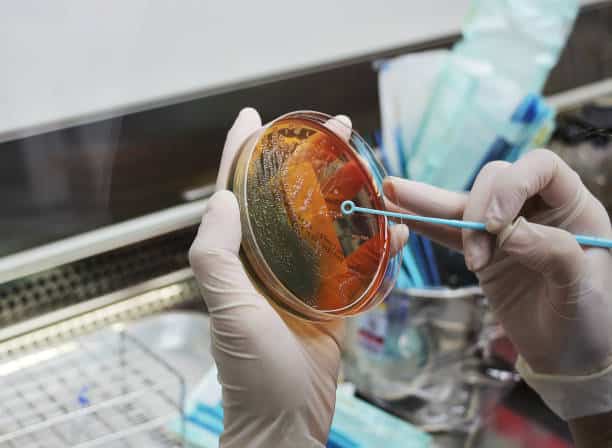 bacteria