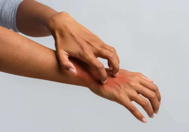 dry skin