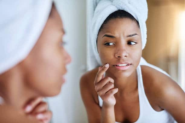 psoriasis