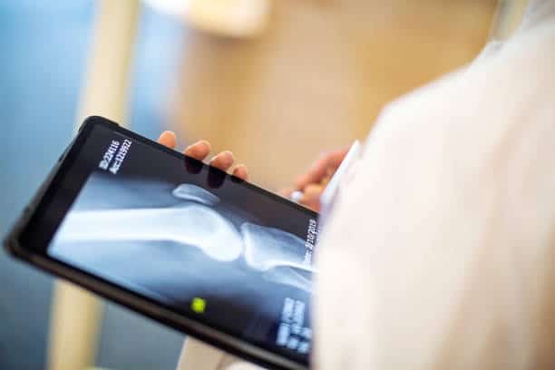 hip replacement surgery