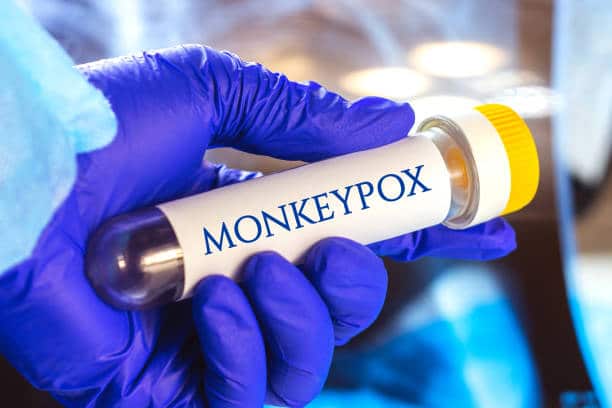 monkeypox