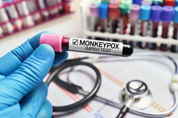 monkeypox