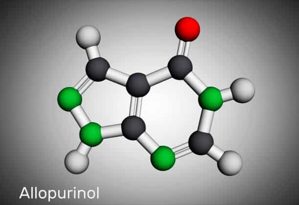 how to prevent kidney stones