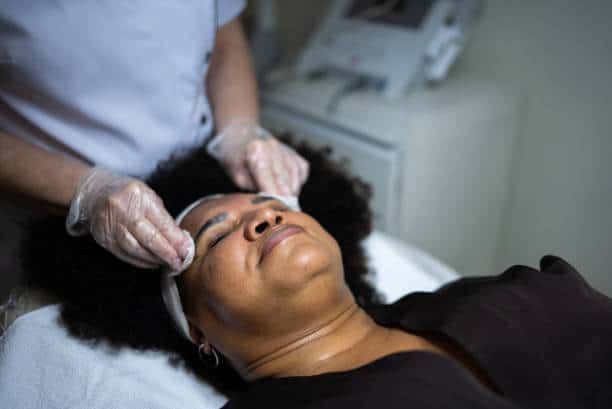 chemical peel