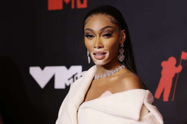 Winnie Harlow
