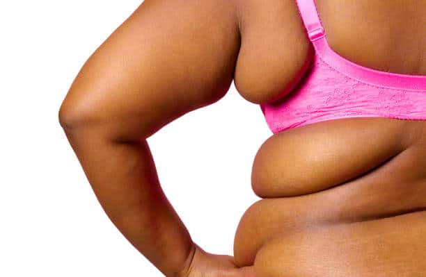 obesity