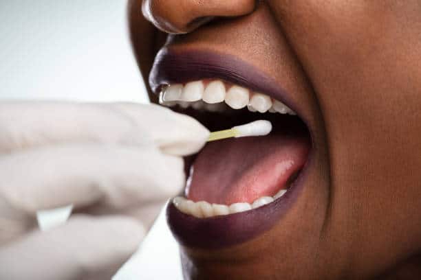 oral cancer signs
