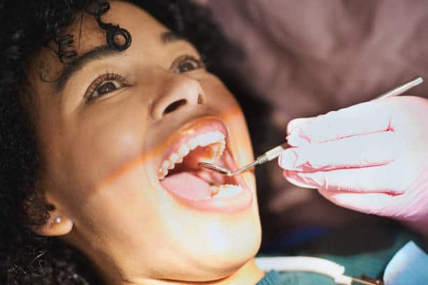 psoriasis in mouth
