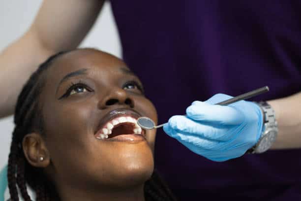psoriasis in mouth