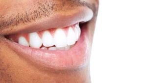 strong teeth gums