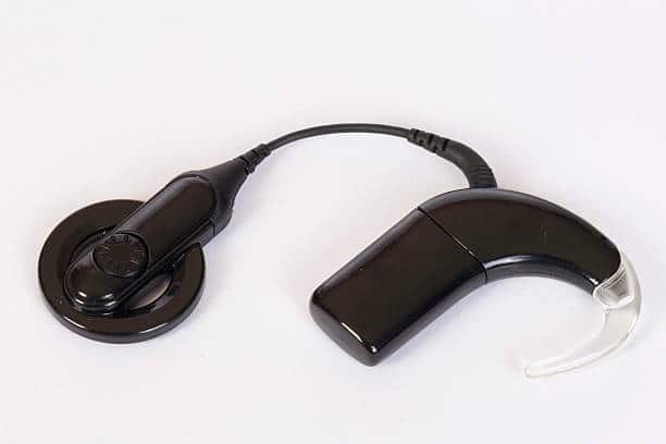 Cochlear Implants
